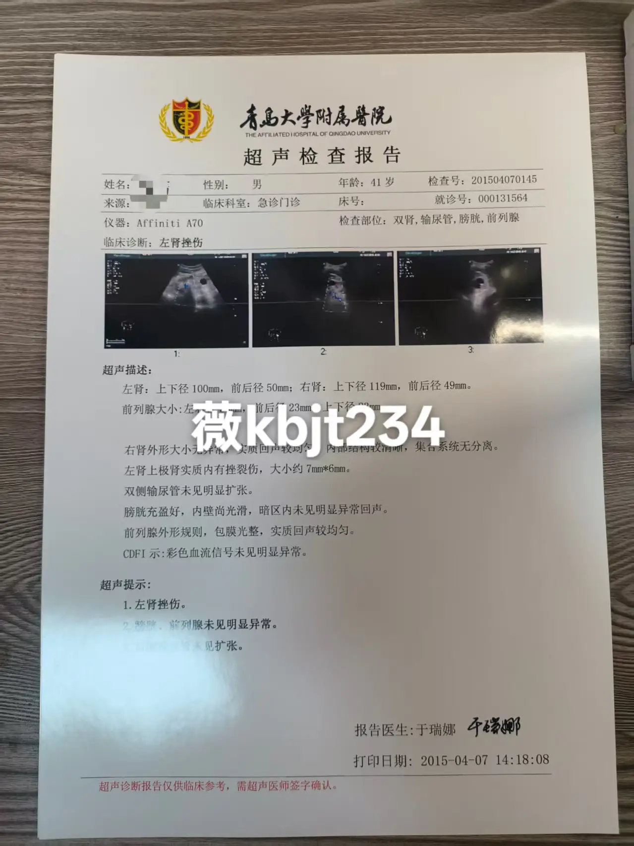 代开医院证明代开b超报告检查报告