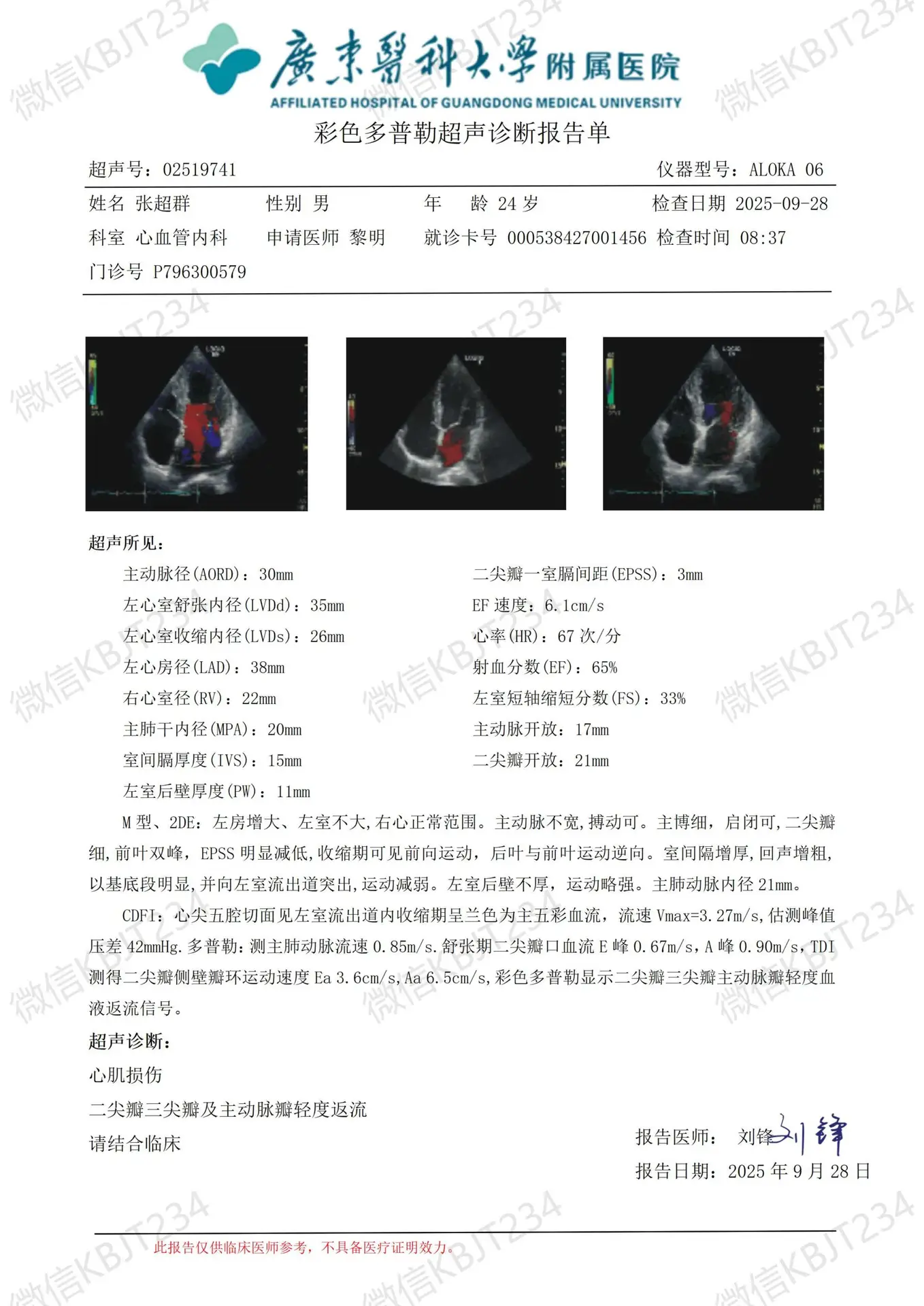 代开心脏彩超报告
