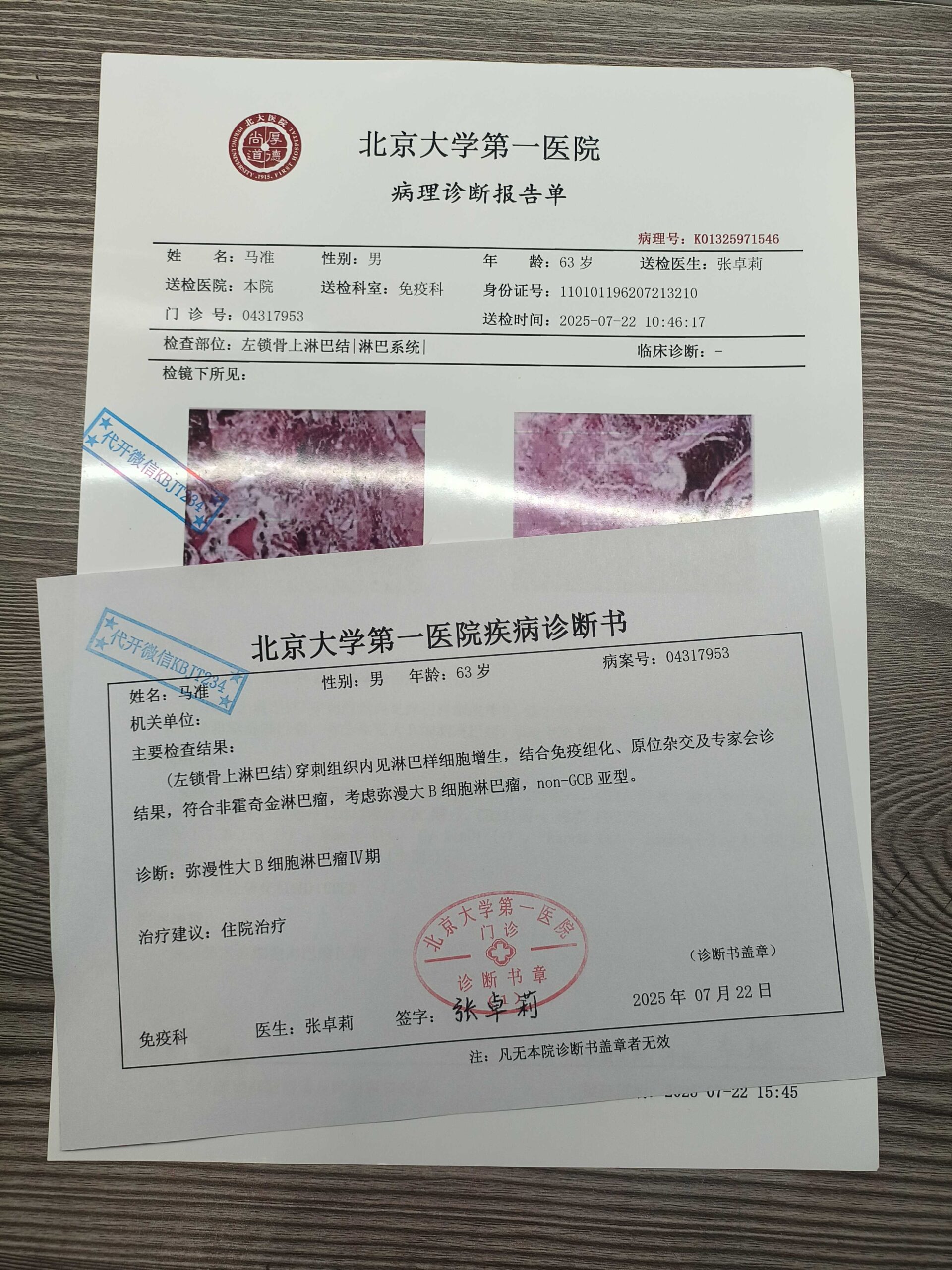 代开癌症病理报告
