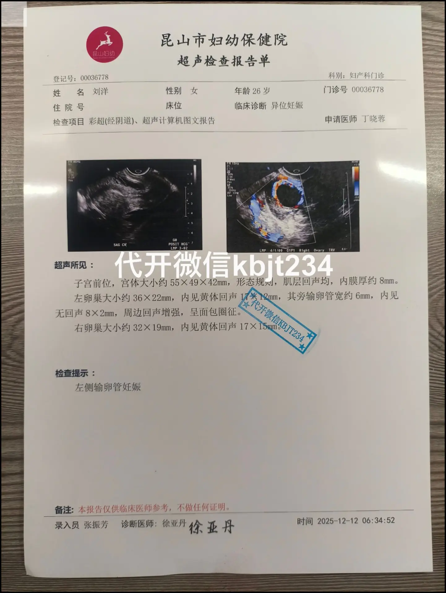 病假证明医院证明代开代开怀孕b超宫外孕证明